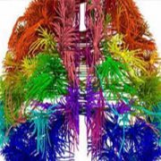 شبکه‌های عصبی مغز